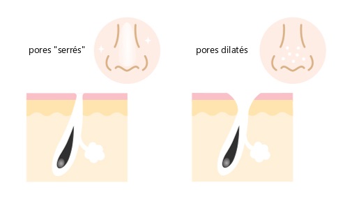 pores-dilates-resserrer-les-pores-peau