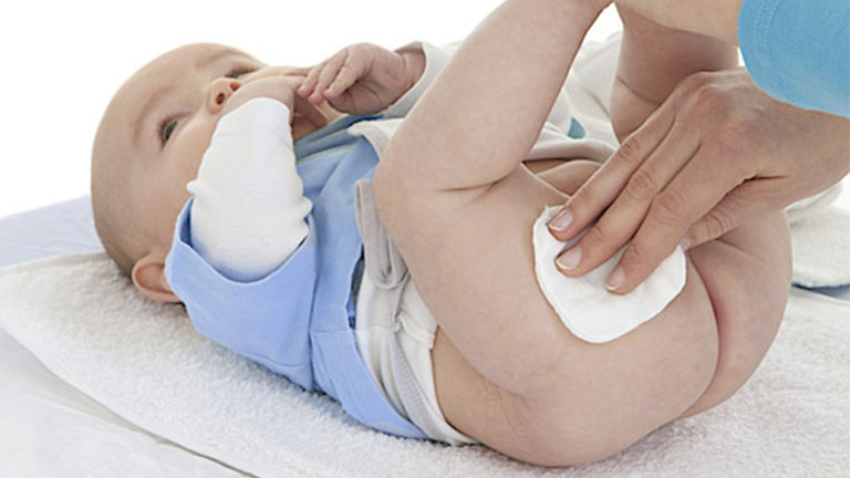 Bébé : comment prévenir ou soulager les fesses rouges naturellement ?