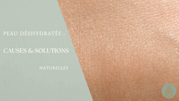 Peau déshydratée : causes & soins naturels